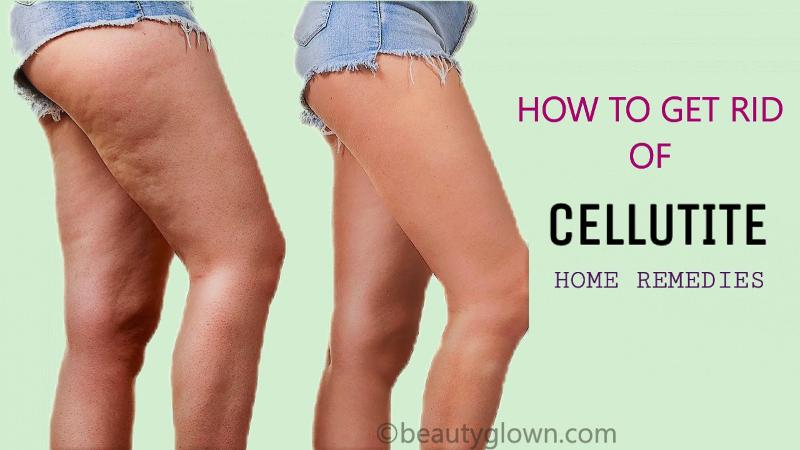 How To Get Rid Of Cellulite Naturally Home Remedies